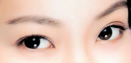 韩式三点双眼皮手术有什么注意事项？