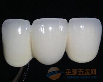 镶一颗钛合金陶瓷牙一般要多少钱？