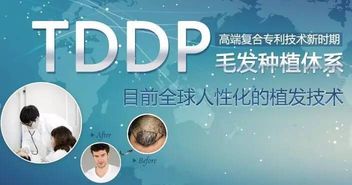 TDDP是什么技术？