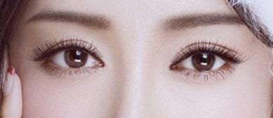 韩式数控双眼皮是武汉哪家医院做的？