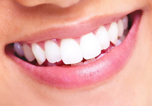 冷光美白牙齿是大概多少钱？