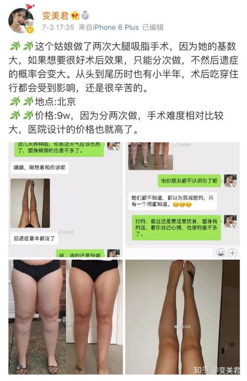北京最好的吸脂整形医师是谁？