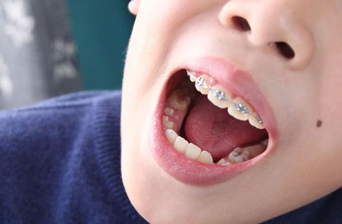 儿童牙齿矫正哪里比较专业？我在北京，朋友介绍青苗儿童口腔，有去过的吗？