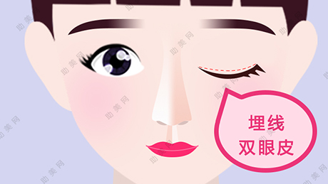 上海名颜埋线双眼皮手术的禁忌症是什么？