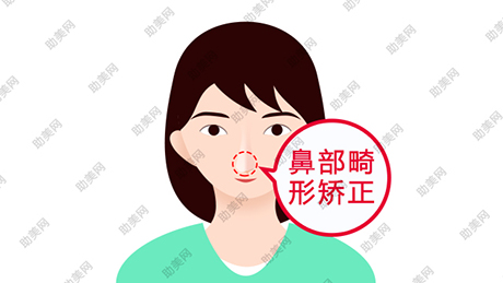 武汉五洲注射隆鼻的材料有哪些？