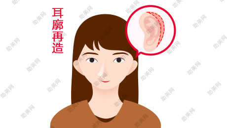 武汉春语耳廓修复的方法是什么？