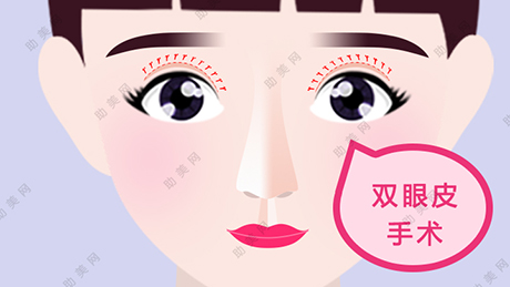哪些人不适合<a href='/tag_zuoshuangyanpishou3.html'>做双眼皮手术</a>呢？